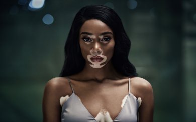 Winnie Harlow Free HD 6K Background Pictures For iPhone Desktop